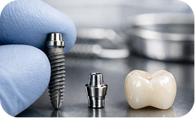 Dental Implant